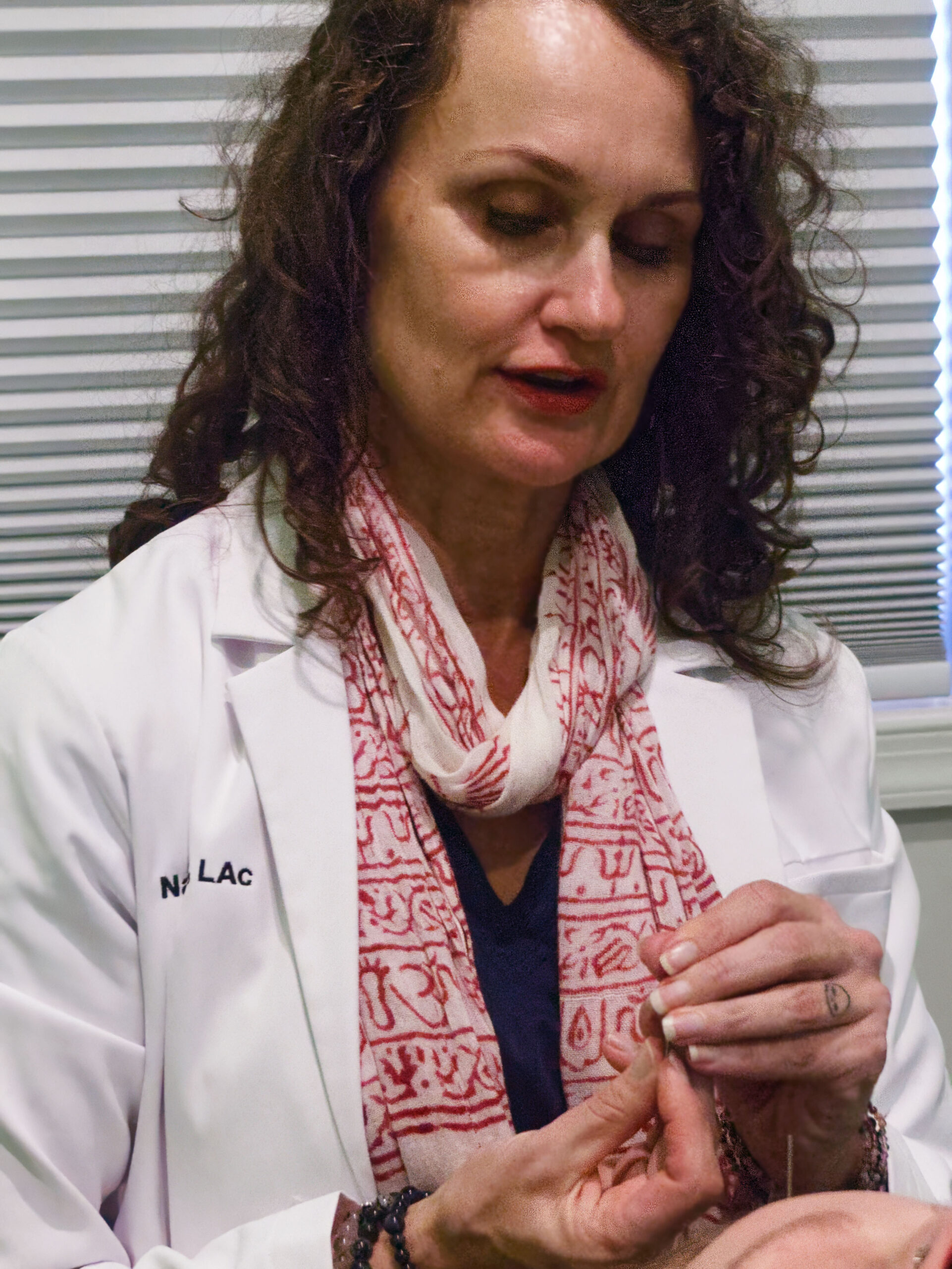 acupuncture for menopause
