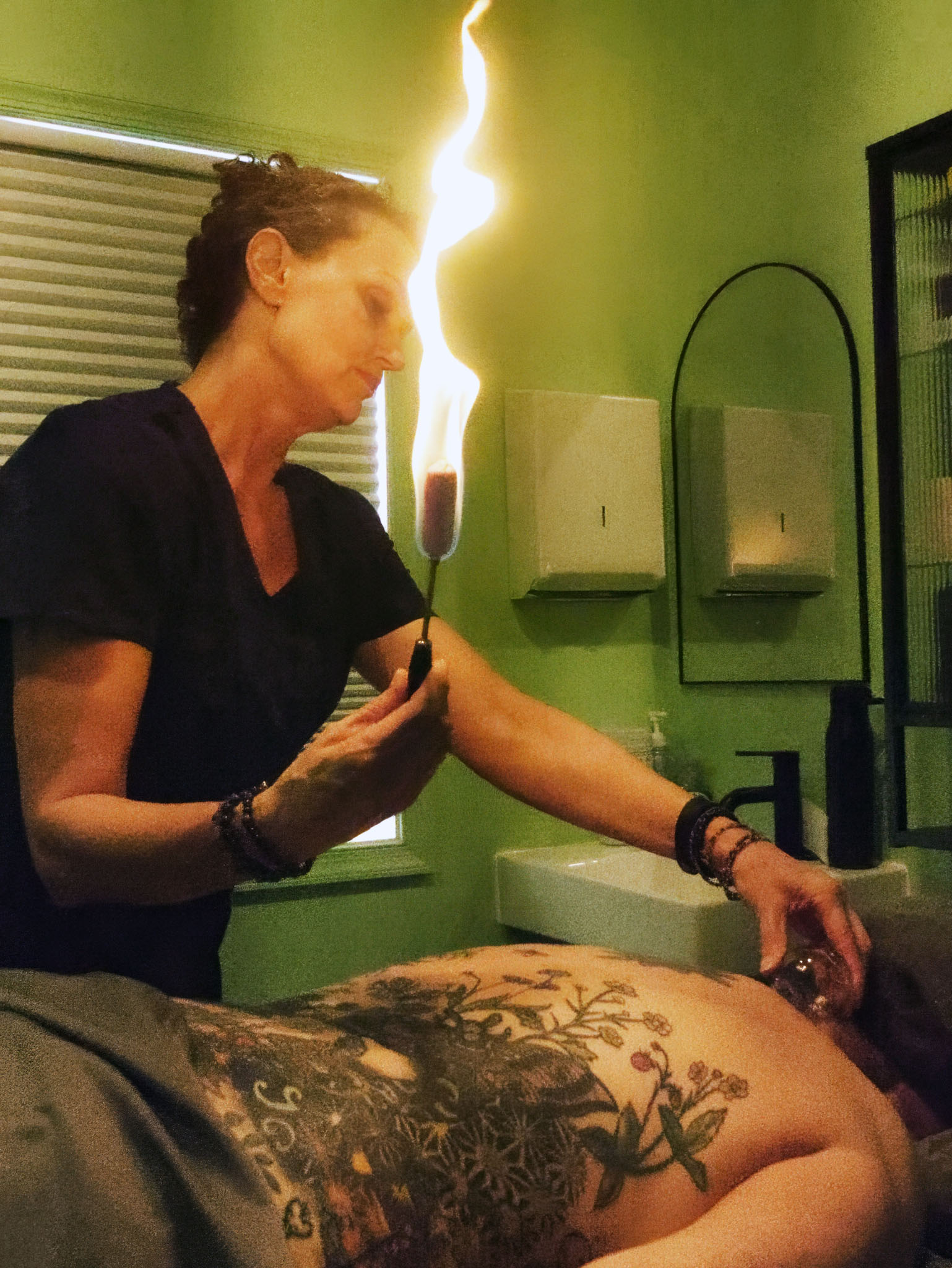 cupping therapy